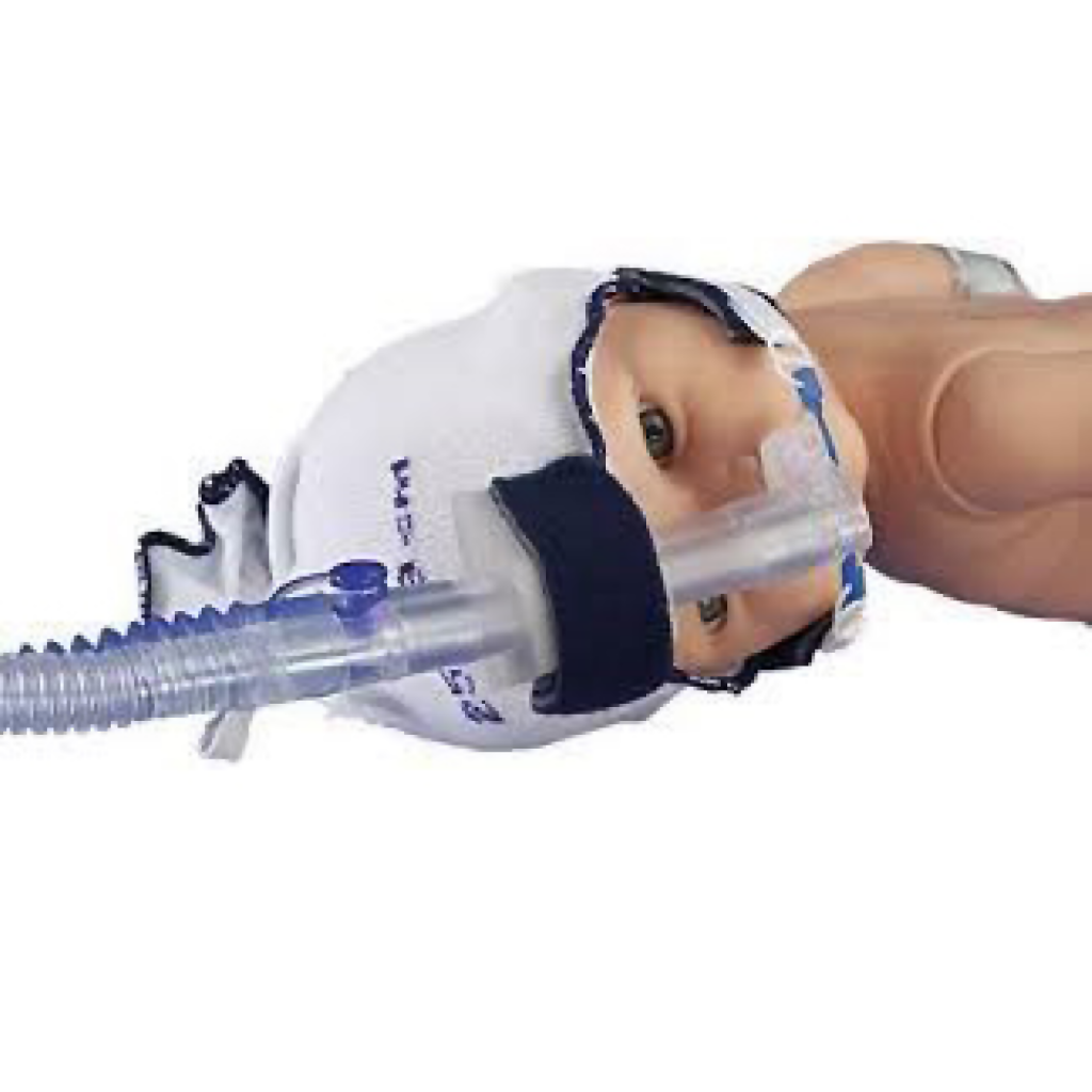 Interface tubo nasal para CPAP de burbuja